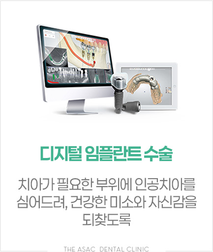 디지털 임플란트 수술