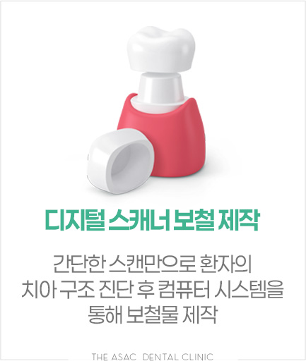 디지털 스캐너 보철 제작