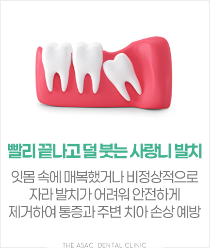 빨리 끝나고 덜 붓는 사랑니 발치