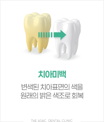 치아미백