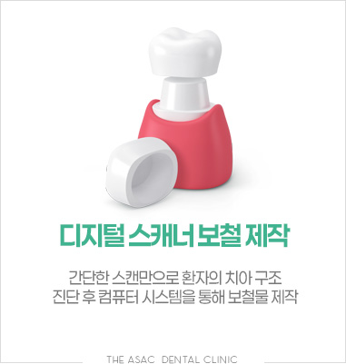 디지털 스캐너 보철 제작