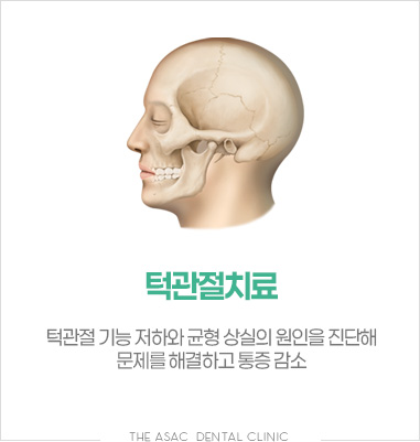 턱관절치료